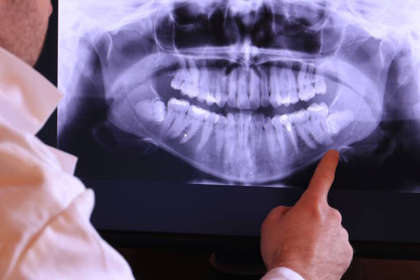 Best After-Hours Emergency Dentist in Silverton, OR
